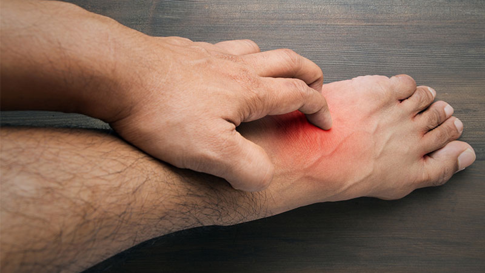 اگزما-پوستی